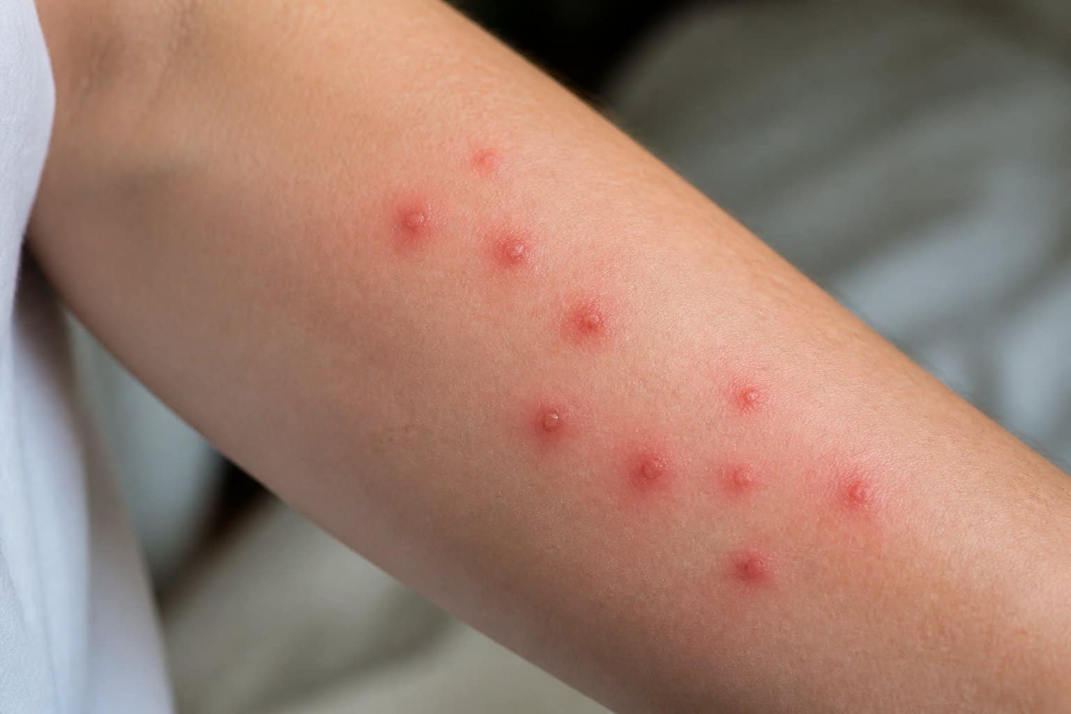 Bed Bugs Bite More Than Once: What To Know Bed Bugs Bite More Than Once: What To Know
