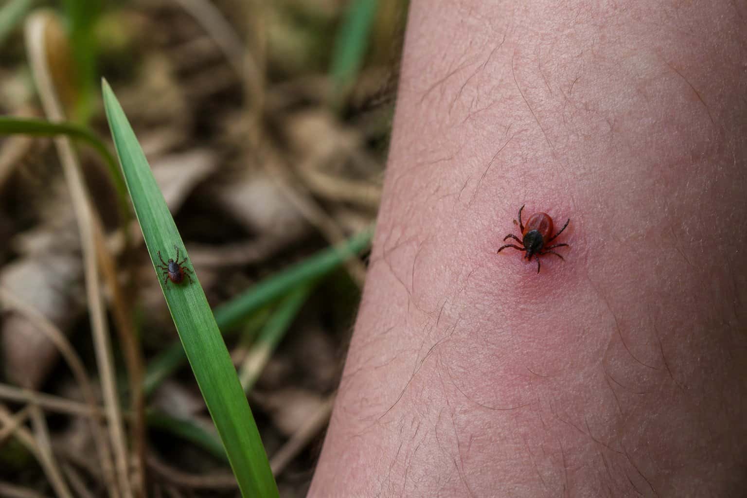 A tick attached to a person’s leg, with another tick on nearby grass in a natural setting.